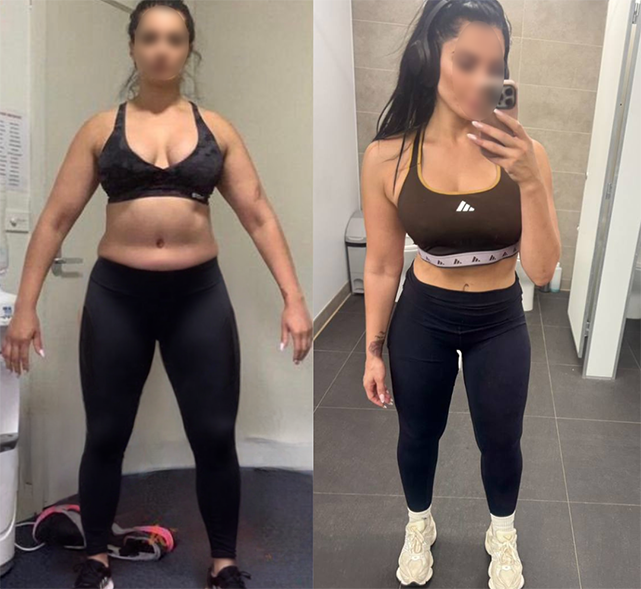Before and After